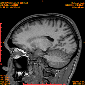 2025-06-14/SAG T1 3D/0097-IM282.png