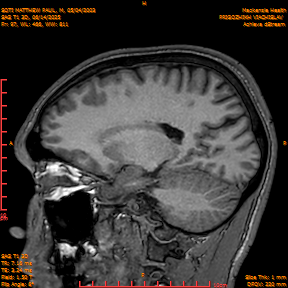 2025-06-14/SAG T1 3D/0098-IM283.png