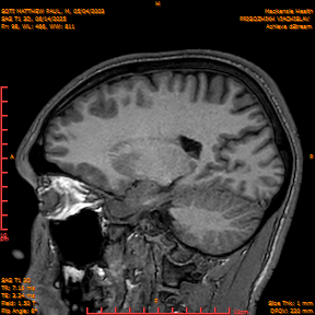 2025-06-14/SAG T1 3D/0099-IM284.png