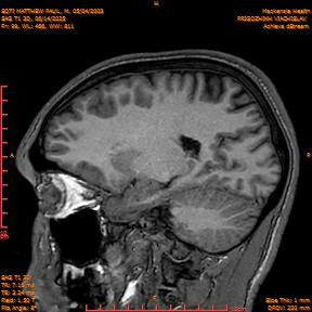 2025-06-14/SAG T1 3D/0100-IM285.png