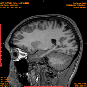 2025-06-14/SAG T1 3D/0102-IM287.png