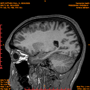 2025-06-14/SAG T1 3D/0103-IM288.png