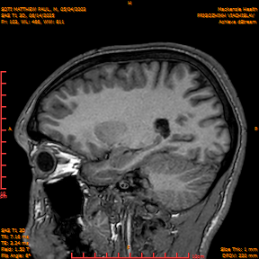 2025-06-14/SAG T1 3D/0104-IM289.png