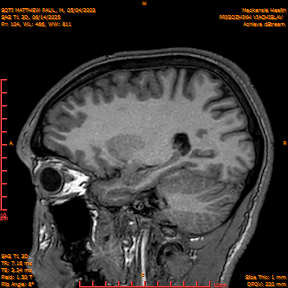 2025-06-14/SAG T1 3D/0105-IM290.png