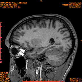 2025-06-14/SAG T1 3D/0106-IM291.png