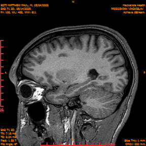 2025-06-14/SAG T1 3D/0107-IM292.png