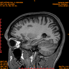2025-06-14/SAG T1 3D/0108-IM293.png