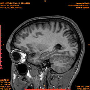 2025-06-14/SAG T1 3D/0109-IM294.png