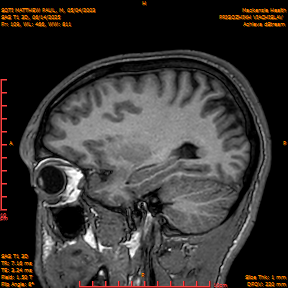 2025-06-14/SAG T1 3D/0110-IM295.png