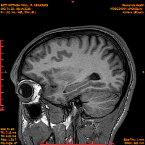 2025-06-14/SAG T1 3D/0111-IM296.png