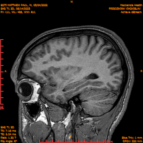 2025-06-14/SAG T1 3D/0112-IM297.png