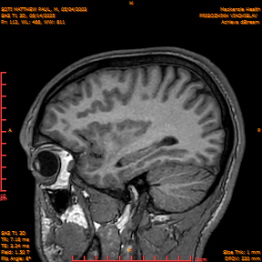 2025-06-14/SAG T1 3D/0113-IM298.png