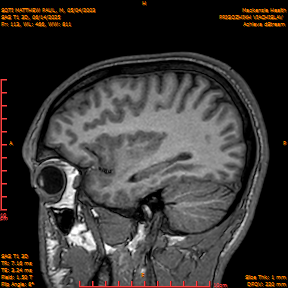 2025-06-14/SAG T1 3D/0114-IM299.png