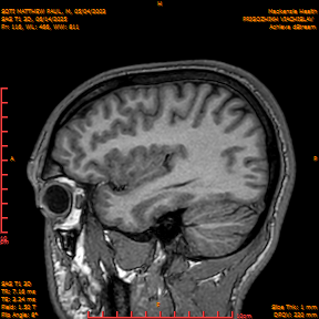 2025-06-14/SAG T1 3D/0117-IM302.png