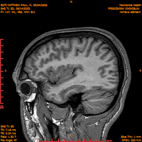 2025-06-14/SAG T1 3D/0118-IM303.png