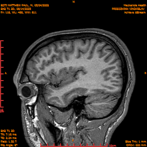 2025-06-14/SAG T1 3D/0119-IM304.png