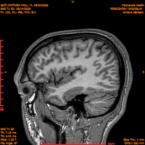 2025-06-14/SAG T1 3D/0121-IM306.png