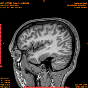 2025-06-14/SAG T1 3D/0122-IM307.png