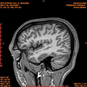 2025-06-14/SAG T1 3D/0123-IM308.png
