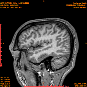 2025-06-14/SAG T1 3D/0124-IM309.png