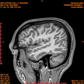 2025-06-14/SAG T1 3D/0125-IM310.png