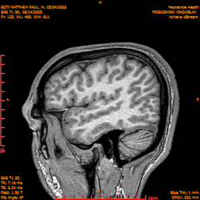 2025-06-14/SAG T1 3D/0126-IM311.png