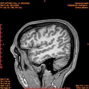 2025-06-14/SAG T1 3D/0127-IM312.png