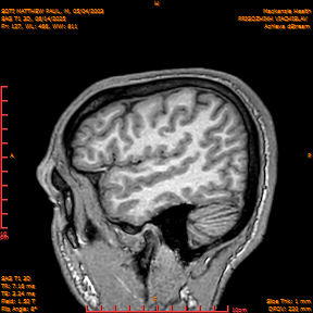 2025-06-14/SAG T1 3D/0128-IM313.png