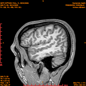 2025-06-14/SAG T1 3D/0129-IM314.png