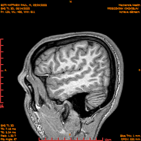 2025-06-14/SAG T1 3D/0130-IM315.png