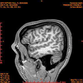 2025-06-14/SAG T1 3D/0132-IM317.png