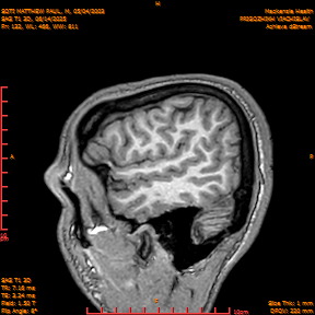 2025-06-14/SAG T1 3D/0133-IM318.png