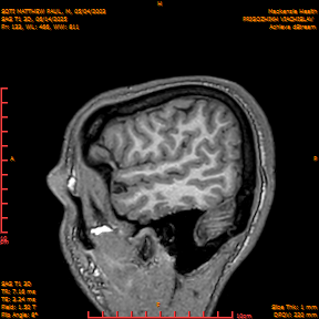 2025-06-14/SAG T1 3D/0134-IM319.png