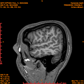 2025-06-14/SAG T1 3D/0135-IM320.png