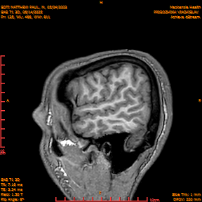 2025-06-14/SAG T1 3D/0136-IM321.png