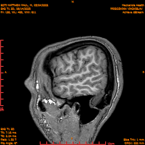 2025-06-14/SAG T1 3D/0137-IM322.png
