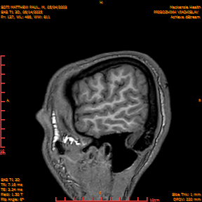 2025-06-14/SAG T1 3D/0138-IM323.png
