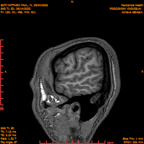 2025-06-14/SAG T1 3D/0140-IM325.png