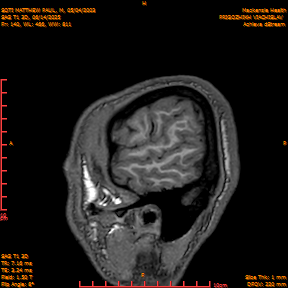 2025-06-14/SAG T1 3D/0141-IM326.png