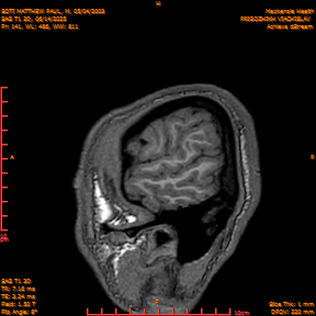 2025-06-14/SAG T1 3D/0142-IM327.png