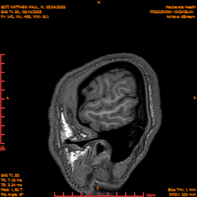 2025-06-14/SAG T1 3D/0143-IM328.png