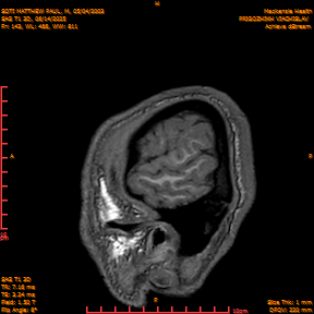 2025-06-14/SAG T1 3D/0144-IM329.png
