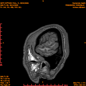 2025-06-14/SAG T1 3D/0145-IM330.png