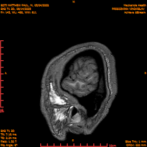 2025-06-14/SAG T1 3D/0146-IM331.png