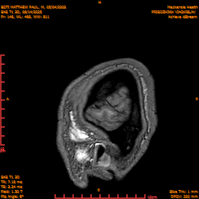 2025-06-14/SAG T1 3D/0147-IM332.png