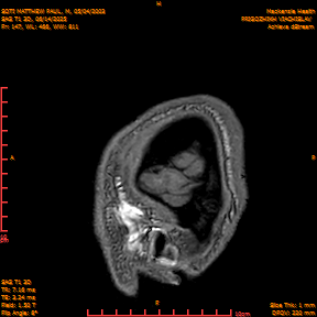 2025-06-14/SAG T1 3D/0148-IM333.png