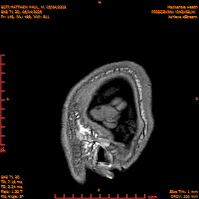 2025-06-14/SAG T1 3D/0149-IM334.png