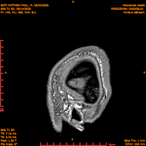 2025-06-14/SAG T1 3D/0150-IM335.png