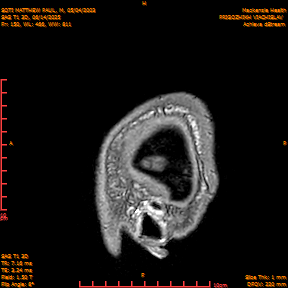 2025-06-14/SAG T1 3D/0151-IM336.png