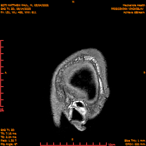 2025-06-14/SAG T1 3D/0152-IM337.png